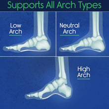 Load image into Gallery viewer, Plantar Series - Full Length Insoles
